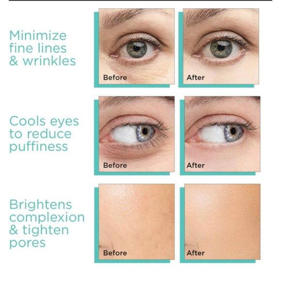 Adrens Beauty Cooling Ice Globes Reduce Puffiness Increase Collagen & Elastin - Picture 13 of 16